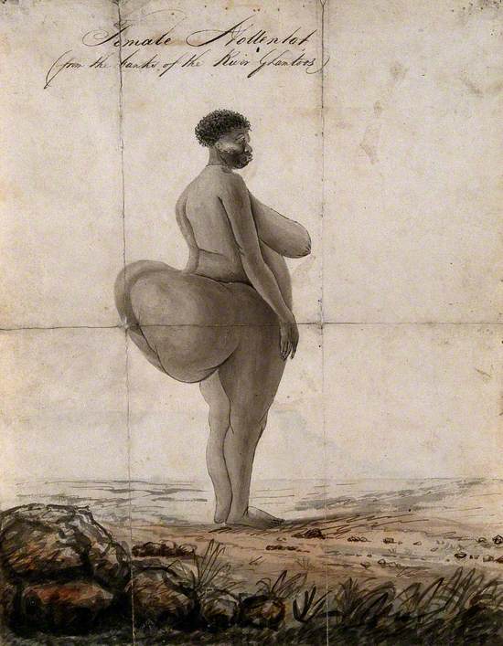 A Hottentot Woman with Prominent Buttocks Due to an Abnormal Accumulation of Fat