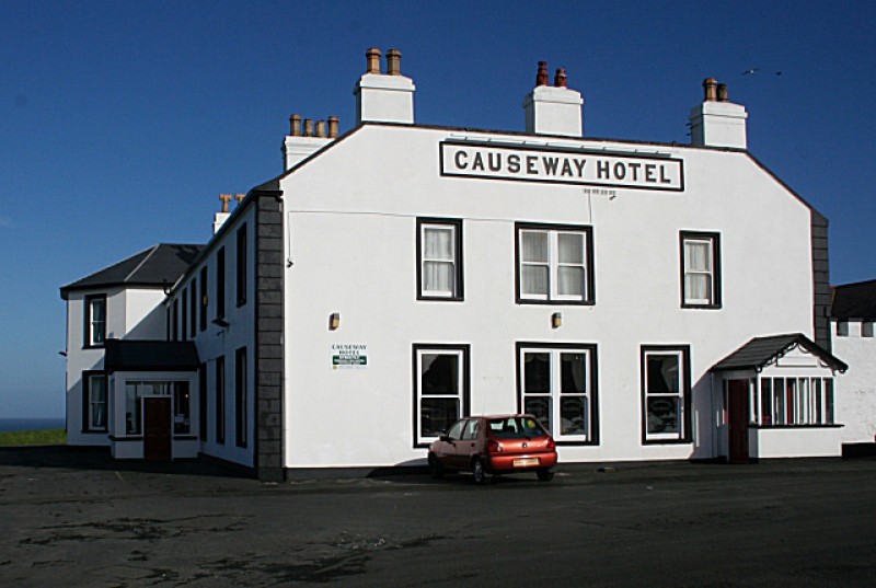 National Trust, The Causeway Hotel