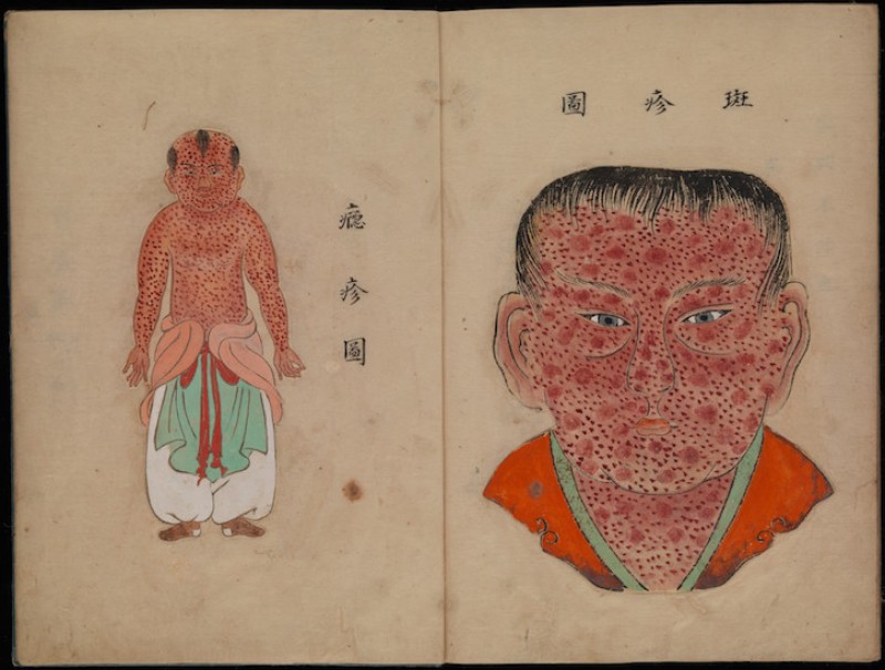 Illustration from 'Toshin seiyo' ('The essentials of smallpox') 