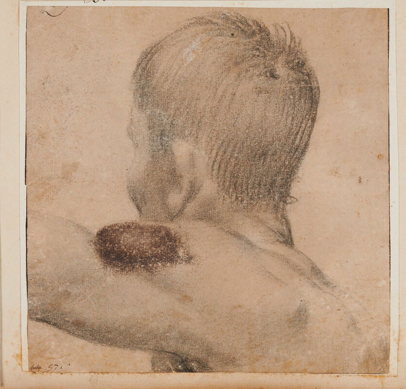 Head and shoulders of a youth seen from behind