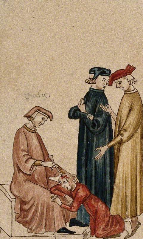 A Sitting Physician Is Trepanning Another Man's Head while Two Others Consult
