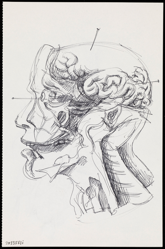 A Human Head and Neck Dissected and Seen from the Side, with the Brain Exposed and Pinned