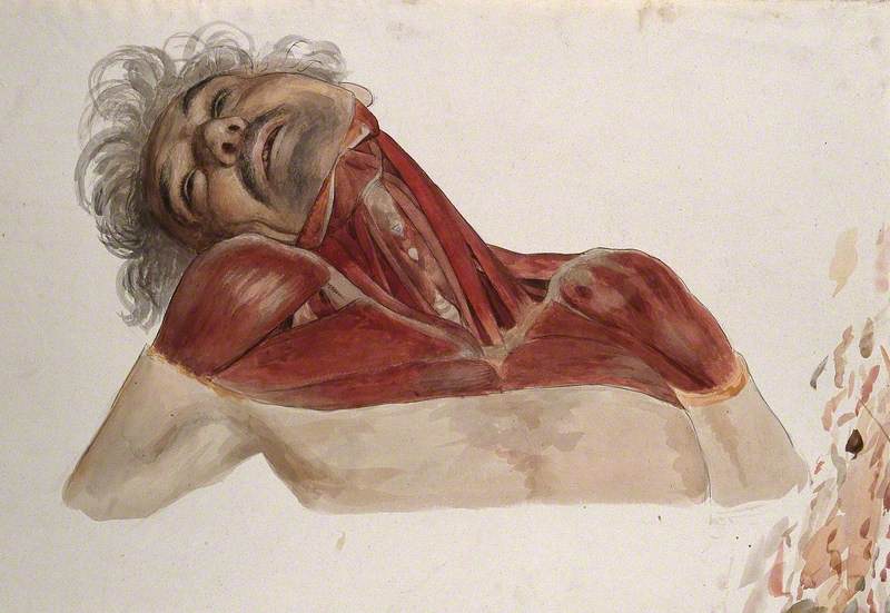 Partially Dissected Head, Shoulders, Chest and Neck of a Man, Showing the Deltoid and Pectoralis Muscles