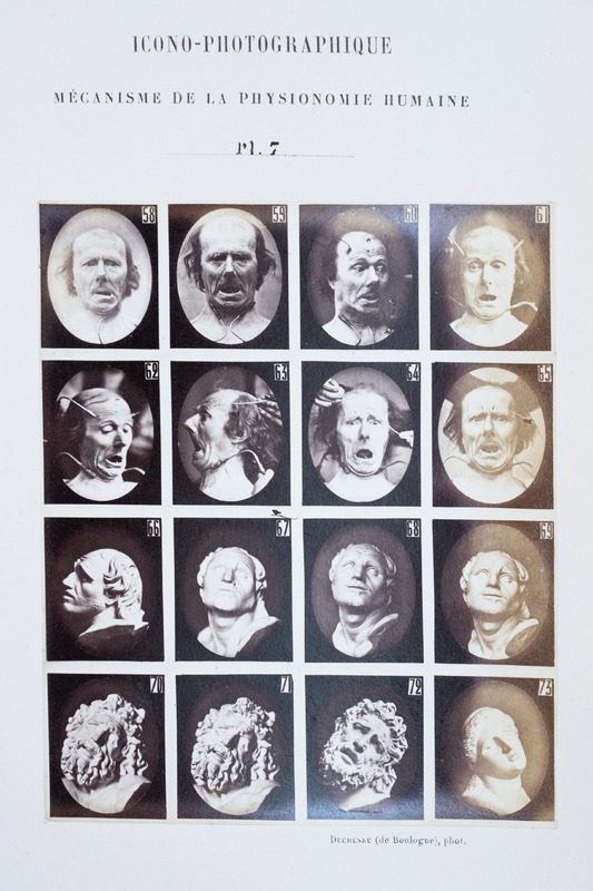 Electrically Induced Facial Expressions
