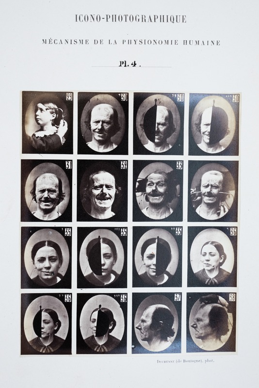 Electrically Induced Facial Expressions