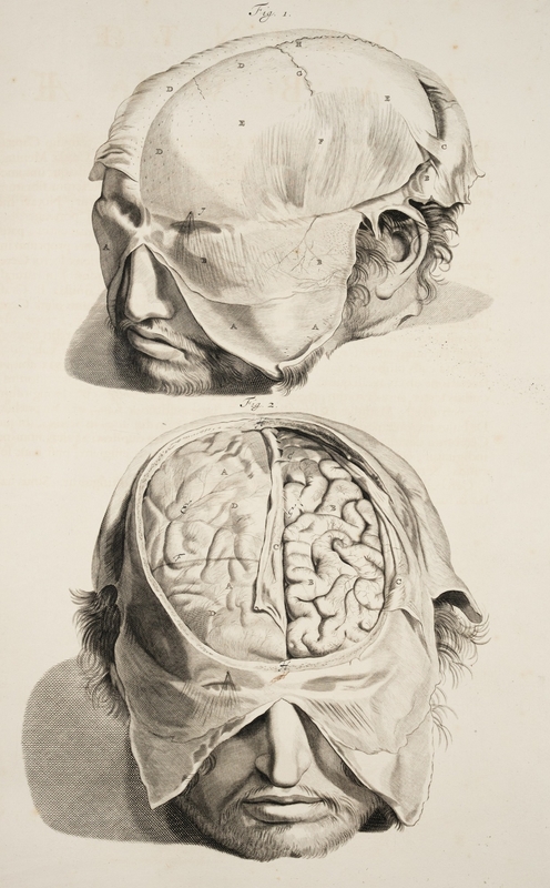 Dissected Heads