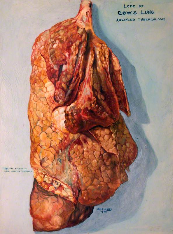 A Lobe of a Cow's Lung: Advanced Tuberculosis
