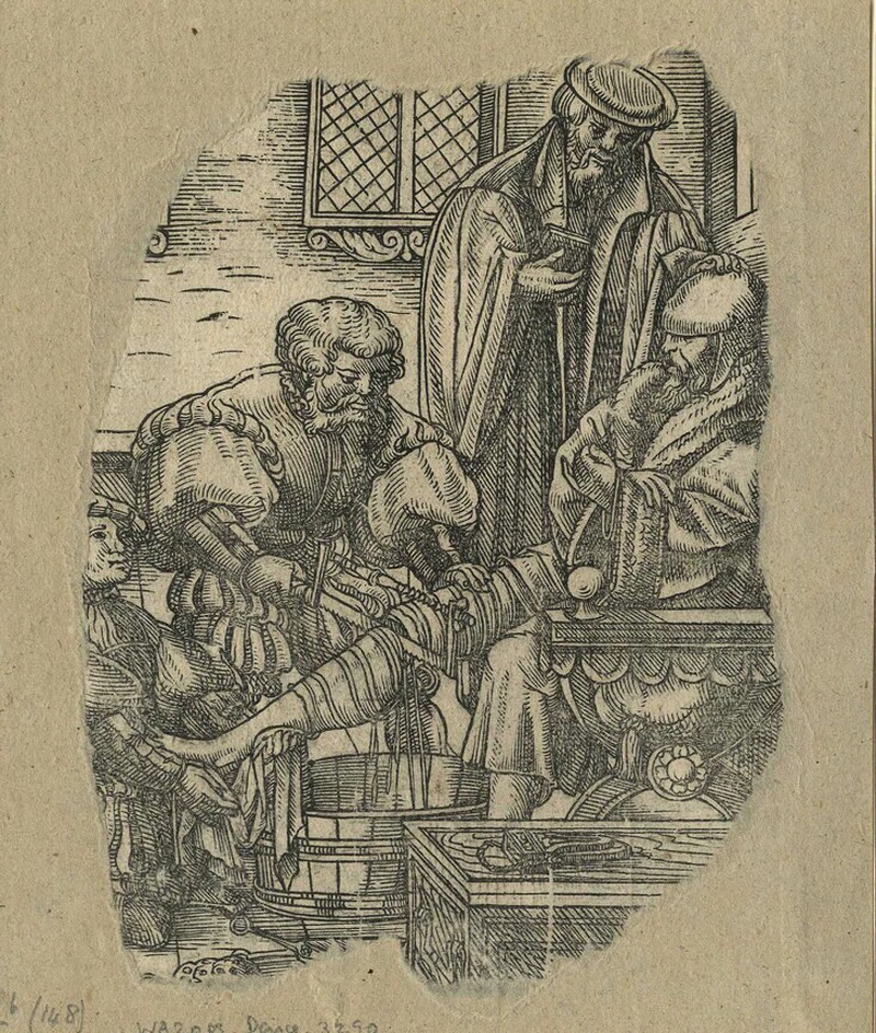 Recto: Women and men in a chapel
Verso: Doctor amputating a man's leg
