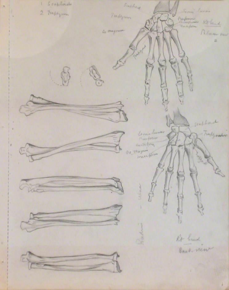 Radius and Ulna, and Skeletal Structures of Right Hand, Back View