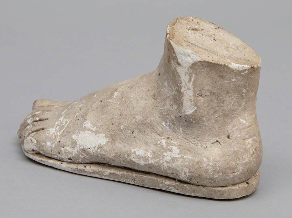 Cast of Child's Foot