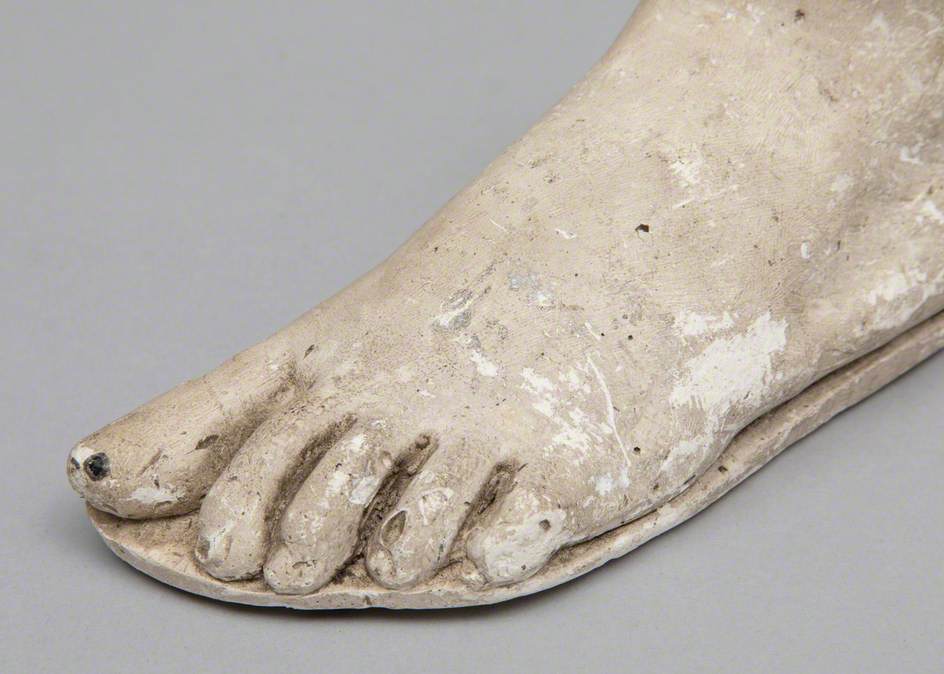Cast of Child's Foot
