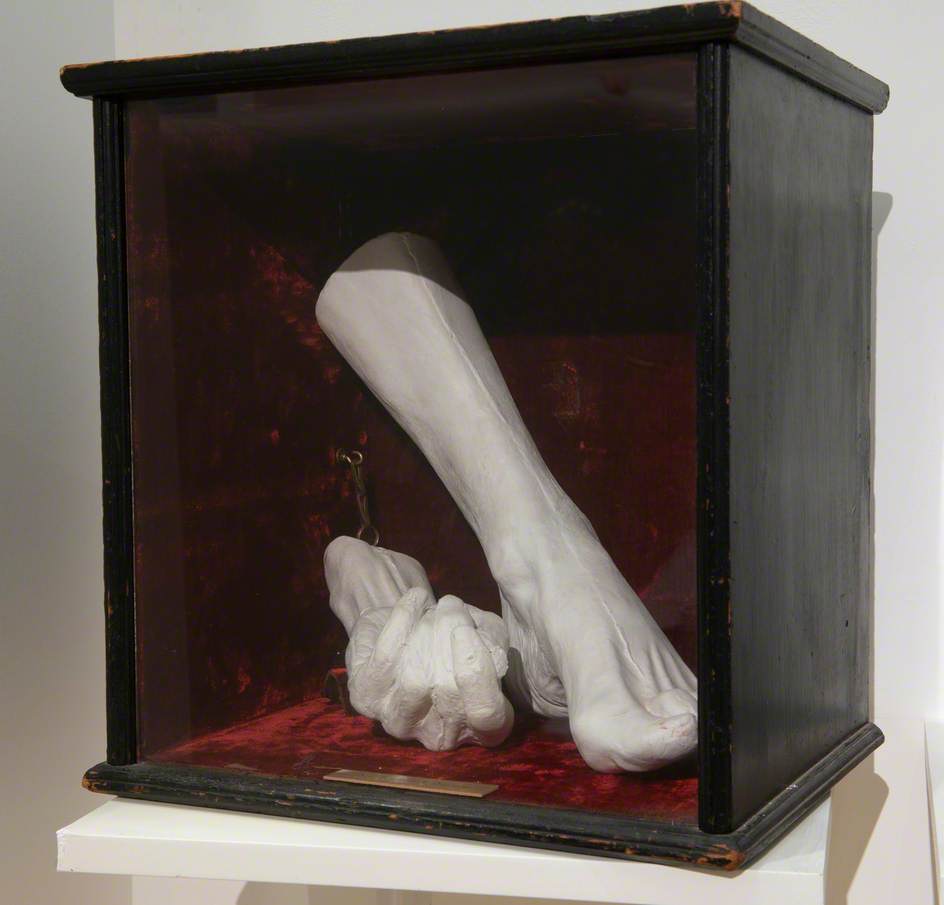 Hand and Foot Cast, Richard Burton (1821–1890)